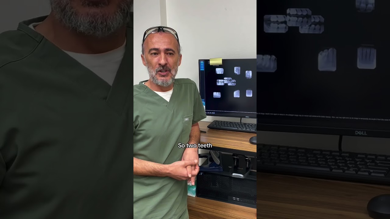 Part 2 coming soon 👀🦷 #patientcase #rootcanal #overdiagnosis #holisticdentistry #dentistryeduc