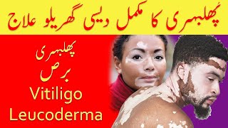 Phulbehri ka ilaj/ Vitiligo Treatment / Bars ka ilaj/پھلبہری کا علاج‎ | Hakeem Malik Ahmad Farooq
