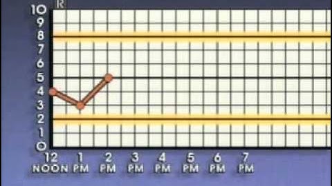 Statistical Process Control Basic Control Charts