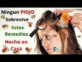 Ningún PIOJO  Sobrevive a estas mezcla casera | Remedios para PIOJOS y LIENDRE