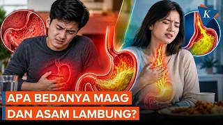 Watch Out for Misdiagnosis! These Are the Differences Between Gastritis and Acid Reflux Symptoms