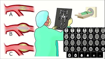 What is IVR? IVR medical coding Concept||interventional radiology concept