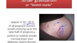 Chapter 28- Moms Anatomical Changes During Pregnancy
