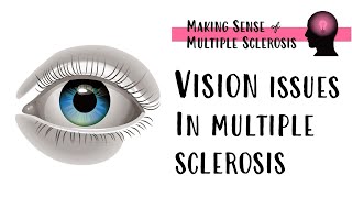 Coping with Vision Issues in MS