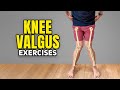 Knock Knee Exercises (Knee Valgus)