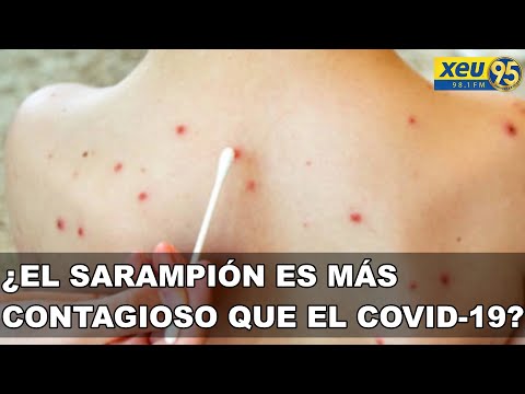 Advierten que sarampión es mucho más contagioso que el COVID-19
