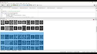 Brain Tumor Segmentation Using Simple CNN Console in Python Projects