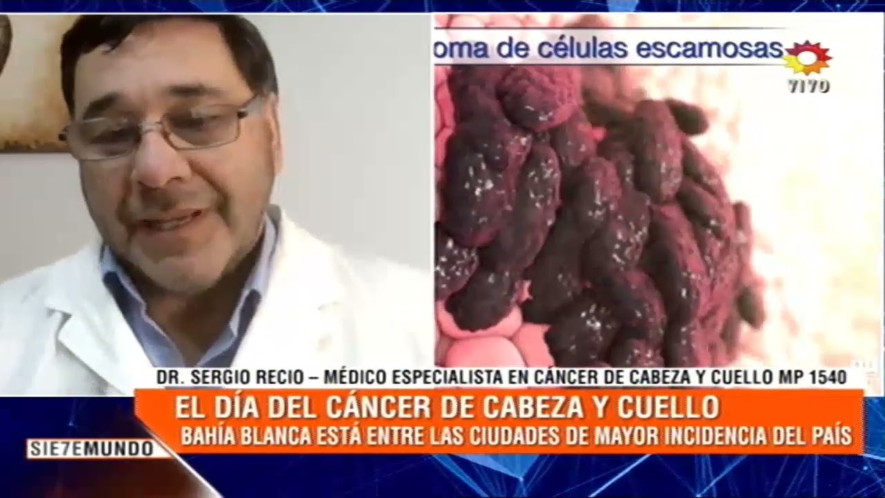 “El cáncer de cabeza y cuello no ha tenido mucha difusión”: el llamado a detectarlo temprano