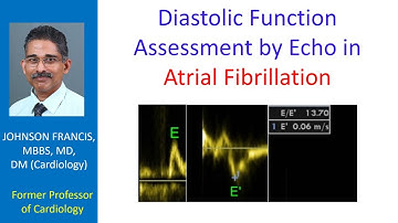 Diastolic function assessment by echo in atrial fibrillation