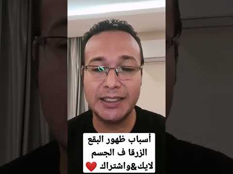 أسباب البقع الزرقاء ف الجسم