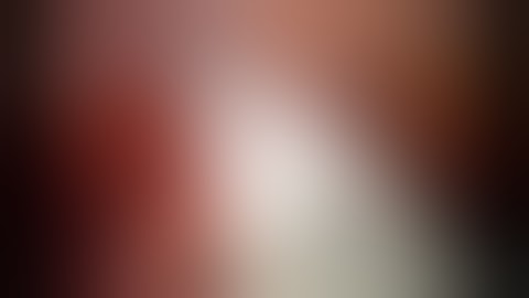 LLL single port VATS powered echelon flex 35 Dr Paolo Loddo