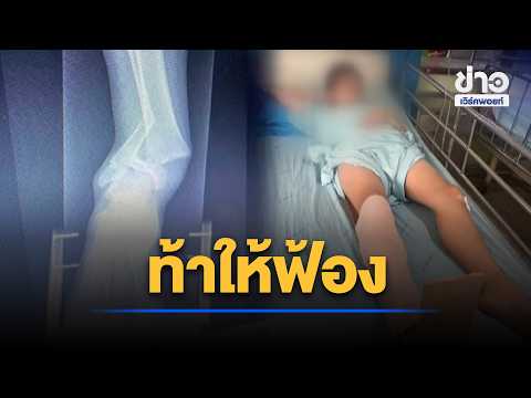 YT 12 Father speaks out! Teacher hit his son, breaking his leg, then refused compensation and dar...