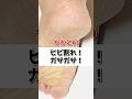 かかとのひび割れ!ガサガサ!#かかとケア #足首
