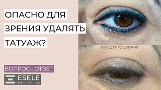 КАК БЕЗОПАСНО УДАЛИТЬ ПЕРМАНЕНТНЫЙ ТАТУАЖ С ГЛАЗ? Удаление Татуажа Лазером и Ревайвинком.