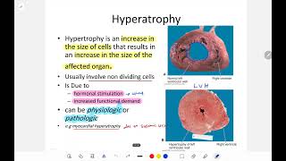 pathology lec 2 part 2 cell injury