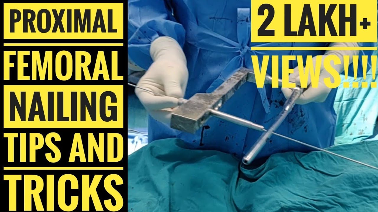 Revolutionizing Foot Surgery: A New Minimally Invasive Technique for Ankle  Joint Surgery