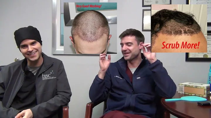 Hair Transplant "PSA:" Wash Your Hair Transplant! ...
