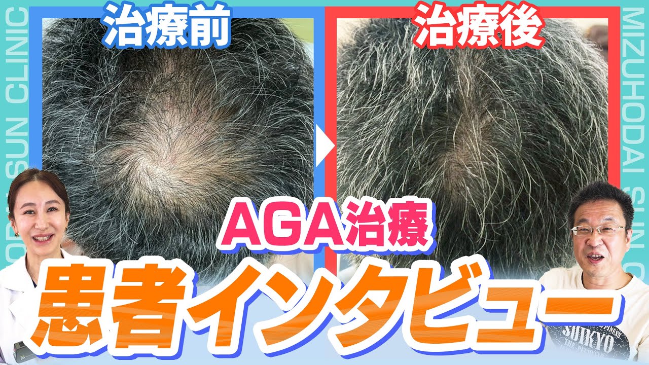 AGA治療】薄毛に気づいて治療開始3カ月で驚くべき効果を実感！ （患者