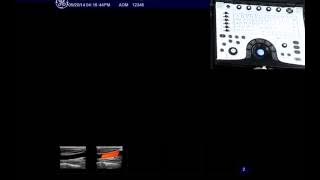 NextGen LOGIQ e: Raw Data