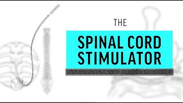 Implant Files: Spinal Cord Stimulator, Explained.
