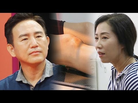 일상조차 힘든 최지연의 무릎상태 ‘무용수의 상처’ @동상이몽 2 - 너는 내운명 56회 20180806