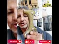 جديد طبيب الجنابي جنابي مصوعي مواصفات صيفاني ملكييه طبيب ألجنابي جنبيه جنابي زراف صيفاني اليمن