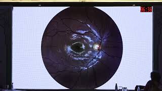 AIOC2026   IC252   T Dr John Davis Akkara Gamut of Disc Imaging  Documentation and Follow up