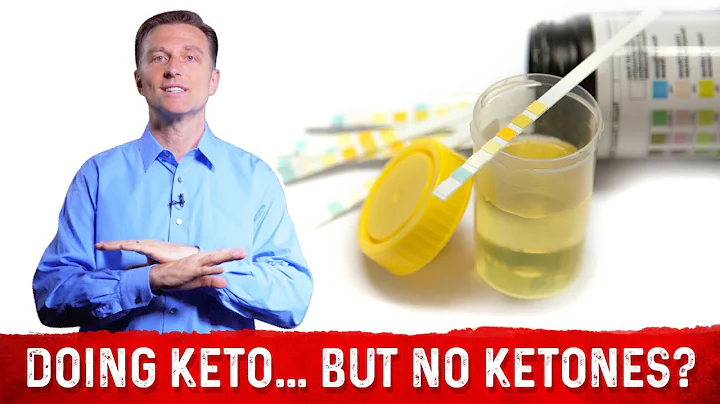 In Ketosis But No Ketones In Urine? – Dr. Berg