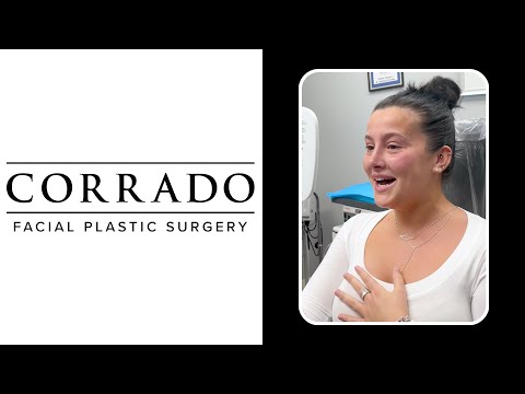 Video thumbnail: Droopy Tip Rhinoplasty Reveal 1 Week Post Op: "It Looks SO Good!" – Before & After Photos · Dr. Anthony Corrado