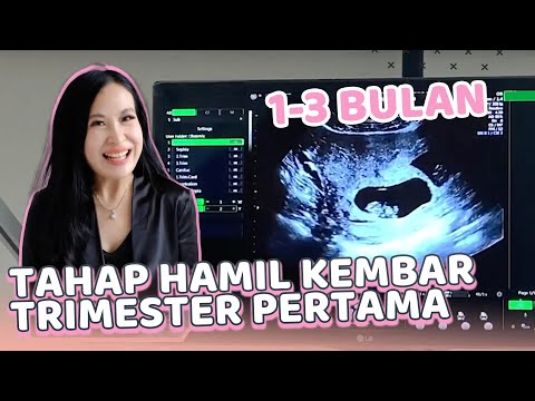 Video: Seperti Apa Si Kembar Di USG?