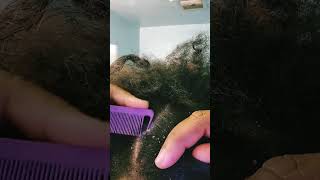 scratchingscalp scalp dandruff flakes asmrflakes