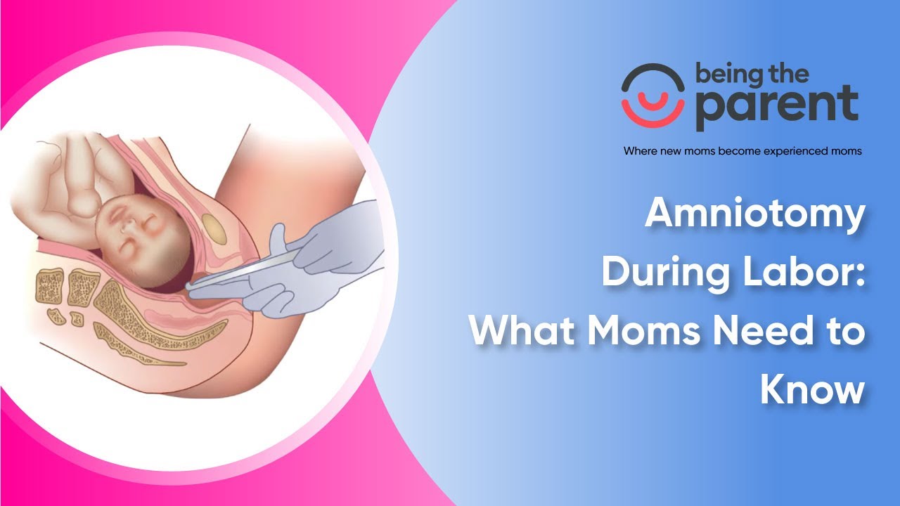 Amniotomy During Labor: What Moms Need to Know - YouTube