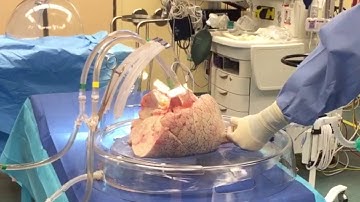 A Day in the Life of a Perfusionist @ UHN