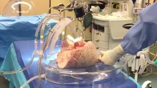 A Day in the Life of a Perfusionist @ UHN