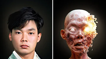 What Happens to a Human Just After Exposure to Radiation of 100 Sieverts