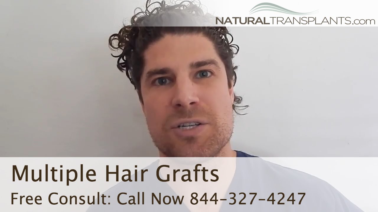 Multiple Hair Grafts & Natural Hair Growth | Hair Transplant West Palm Beach