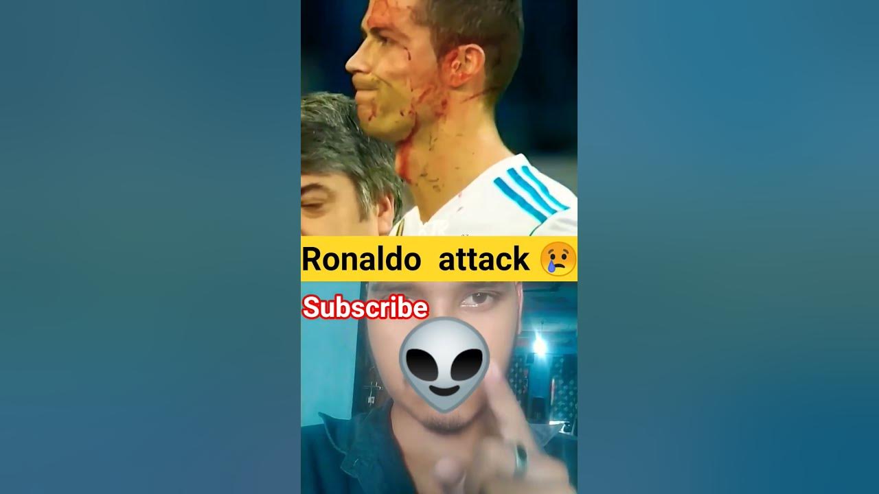 ronaldo injury 🤕 #football #bikky003 #ytshorts #trendingshorts #funny