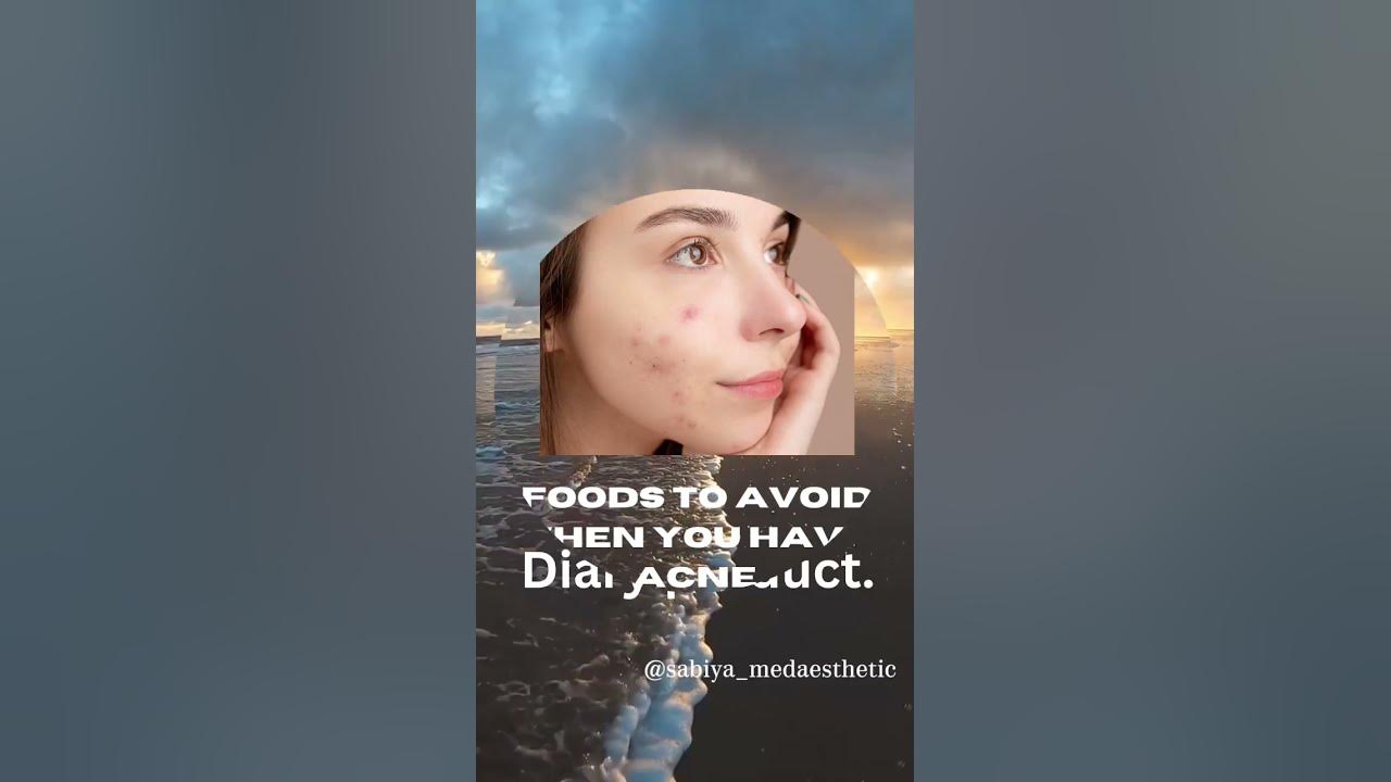 food-to-avoid-when-you-have-acne-youtube