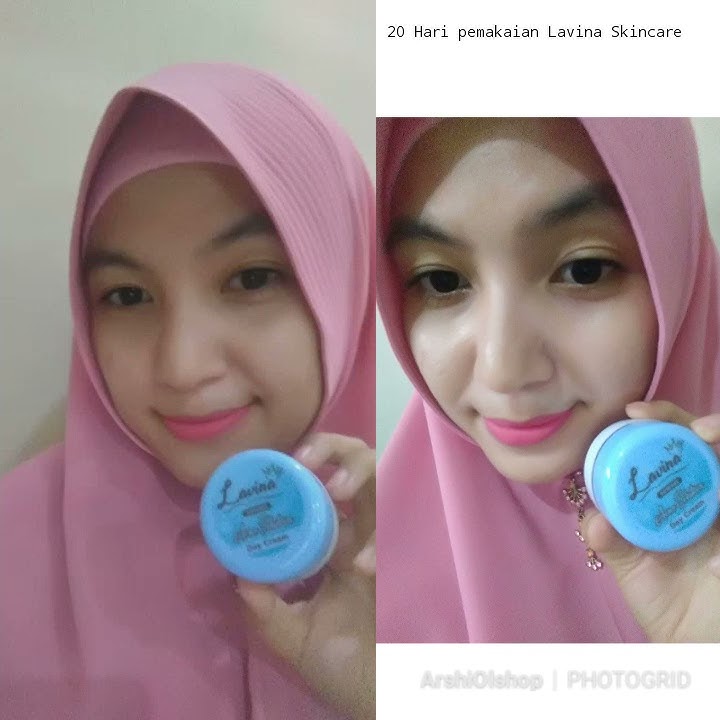 Lavina Skincare Acne Series 💎 #lavina #livelovelavina #lavinaskincare #lavinaskincareindonesia