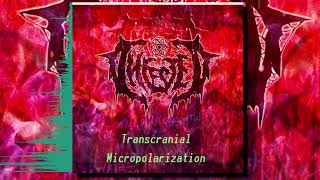 IFested — Transcranial Micropolarization (320)