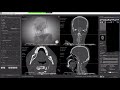 Using the Segmentation Wizard tool to train a Deep Learning model for your image segmentation tasks.