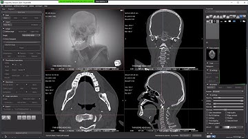 Using the Segmentation Wizard tool to train a Deep Learning model for your image segmentation tasks.