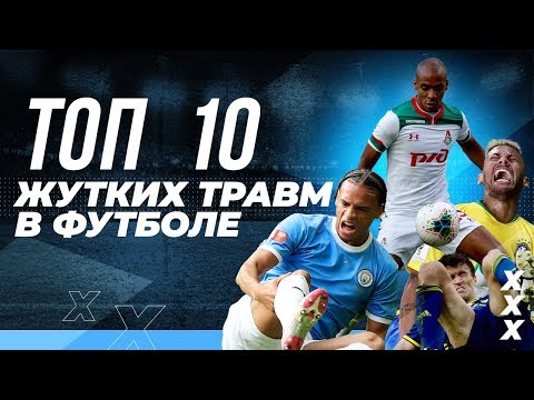 ТОП 10 САМЫХ ЖУТКИХ ТРАВМ В ФУТБОЛЕ
