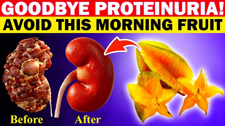 Goodbye Proteinuria! Avoid These 4 Morning Fruits and Eat These 4 Instead to Heal Kidneys!