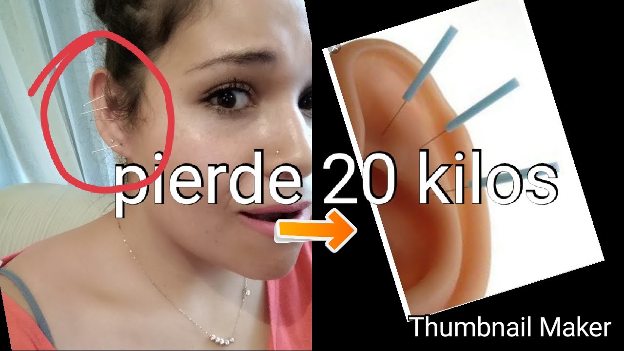 BALINES Y AGUJAS PARA PERDER PESO COLOCACIÓN CORRECTA YouTube