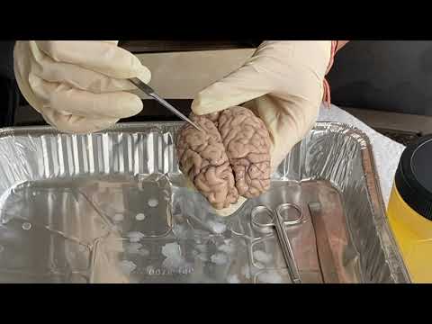 sheep brain dissection | identifying major structures and functions