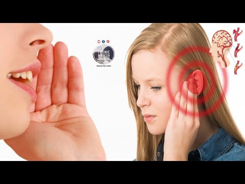 Video: 3 mënyra për të ndaluar një gjel nga zhurma