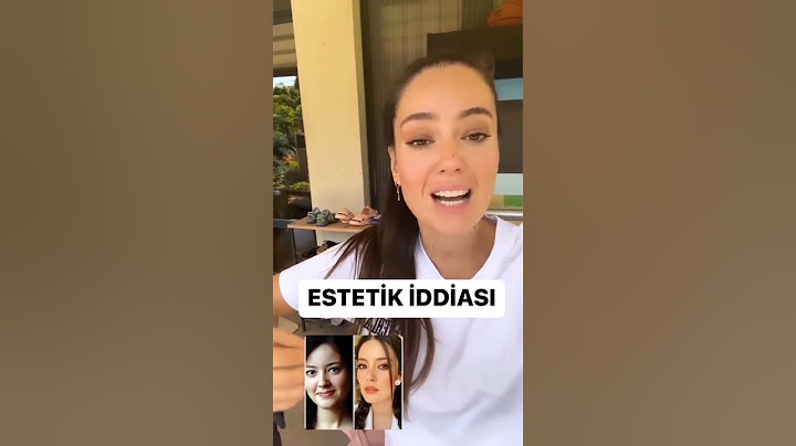 Pelin Akil Estetik İddialarını Yalanladı. Sizce Estetik Var Mı? #pelinakil #magazin #estetik