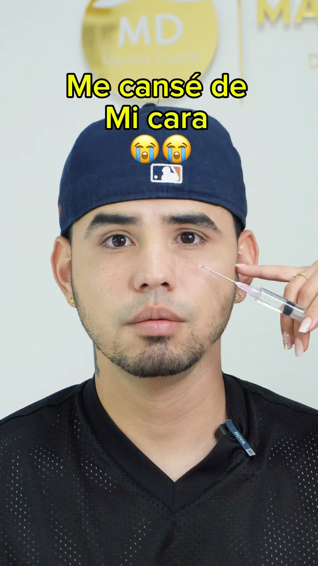 Me cansé de mi cara :( #botox #estetica