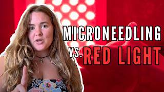 Microneedling or Red Light Therapy? (I Tried Both for Acne Scars)